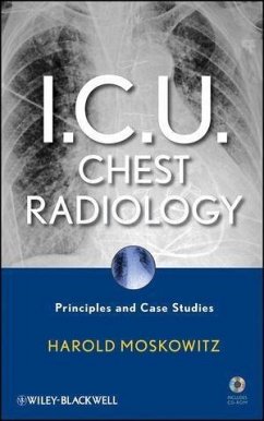 I.C.U. Chest Radiology (eBook, ePUB) - Moskowitz, Harold