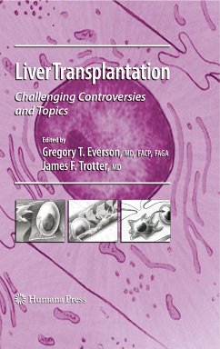 Liver Transplantation (eBook, PDF)