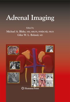 Adrenal Imaging (eBook, PDF)