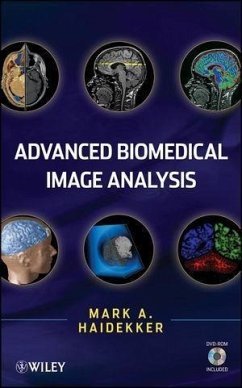 Cover Advanced Biomedical Image Analysis (eBook, ePUB)