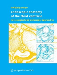 Cover Endoscopic Anatomy of the Third Ventricle (eBook, PDF)