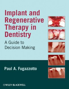 Implant and Regenerative Therapy in Dentistry (eBook, PDF) - Fugazzotto, Paul A.