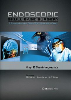 Endoscopic Skull Base Surgery (eBook, PDF) - Shahinian, Hrayr K.