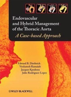 Endovascular and Hybrid Management of the Thoracic Aorta (eBook, PDF) - Diethrich, Edward B.; Ramaiah, Venkatesh; Kpodonu, Jacques; Rodriguez-Lopez, Julio A.