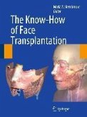 The Know-How of Face Transplantation (eBook, PDF)