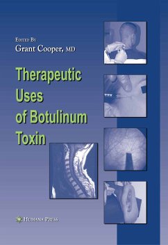Therapeutic Uses of Botulinum Toxin (eBook, PDF)