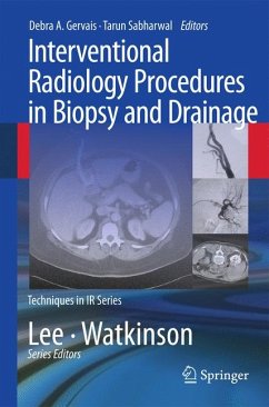 Interventional Radiology Procedures in Biopsy and Drainage (eBook, PDF)