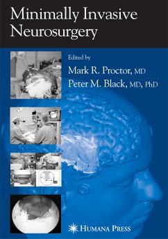 Minimally Invasive Neurosurgery (eBook, PDF)