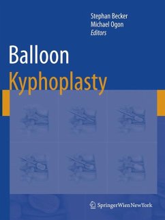Balloon Kyphoplasty (eBook, PDF)