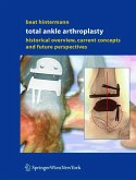 Total Ankle Arthroplasty (eBook, PDF)