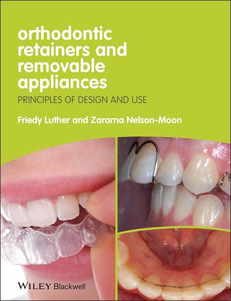 Orthodontic Retainers and Removable Appliances (eBook, ePUB) Orthodontic Retainers and Removable Appliances (eBook, ePUB)