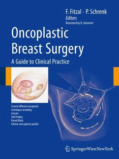 Oncoplastic Breast Surgery (eBook, PDF)