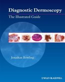Diagnostic Dermoscopy (eBook, ePUB) Diagnostic Dermoscopy (eBook, ePUB)