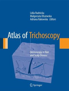 Atlas of Trichoscopy (eBook, PDF)