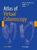 Atlas of Virtual Colonoscopy (eBook, PDF)