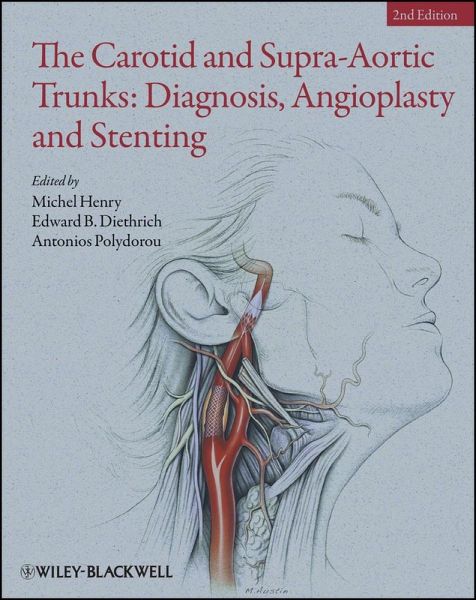 The Carotid and Supra-Aortic Trunks (eBook, PDF)