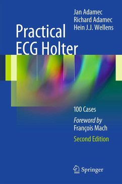 Practical ECG Holter (eBook, PDF)