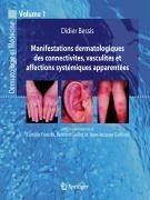 Cover Manifestations dermatologiques des connectivites, vasculites et affections systémiques apparentées (eBook, PDF)