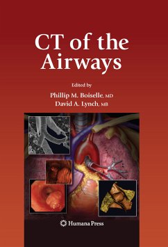 CT of the Airways (eBook, PDF)