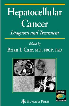 Hepatocellular Carcinoma (eBook, PDF) - Carr, Brian I.