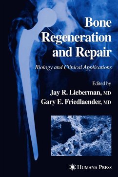 Bone Regeneration and Repair (eBook, PDF)