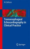 Transesophageal Echocardiography in Clinical Practice (eBook, PDF)
