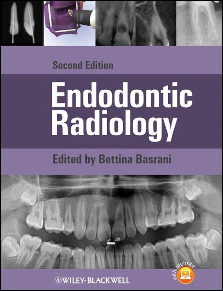 Endodontic Radiology (eBook, PDF)