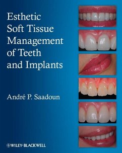 Esthetic Soft Tissue Management of Teeth and Implants (eBook, ePUB) - Saadoun, Andre P.