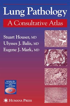 Lung Pathology (eBook, PDF) - Houser, Stuart; Mark, Eugene J.; Balis, Ulysses J.