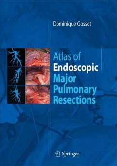 Atlas of endoscopic major pulmonary resections (eBook, PDF) - Gossot, Dominique