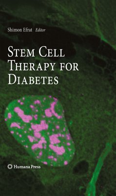 Stem Cell Therapy for Diabetes (eBook, PDF)