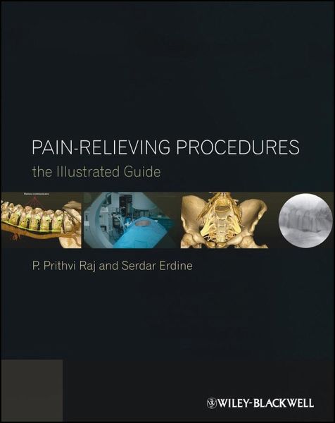Pain-Relieving Procedures (eBook, PDF) Pain-Relieving Procedures (eBook, PDF)