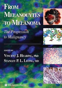 From Melanocytes to Melanoma (eBook, PDF)