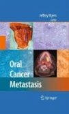 Oral Cancer Metastasis (eBook, PDF)