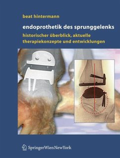 Endoprothetik des Sprunggelenks (eBook, PDF) - Hintermann, Beat
