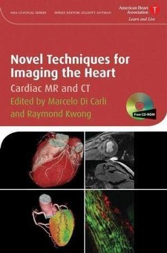 Novel Techniques for Imaging the Heart (eBook, PDF)