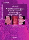 Manifestations dermatologiques des maladies du système hématopoïétique et oncologie dermatologique (eBook, PDF)
