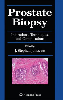 Prostate Biopsy (eBook, PDF)