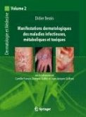 Manifestations dermatologiques des maladies infectieuses, métaboliques et toxiques (eBook, PDF)