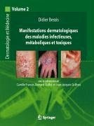 Manifestations dermatologiques des maladies infectieuses, métaboliques et toxiques (eBook, PDF) - Bessis, Didier