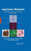 Lung Cancer Metastasis (eBook, PDF)