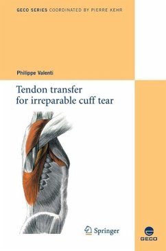 Cover Tendon transfer for irreparable cuff tear (eBook, PDF)