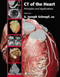 CT of the Heart (eBook, PDF)