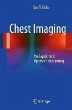 Chest Imaging (eBook, PDF) - Bild 1