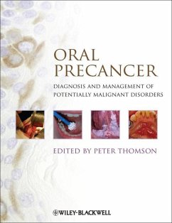 Oral Precancer (eBook, PDF)