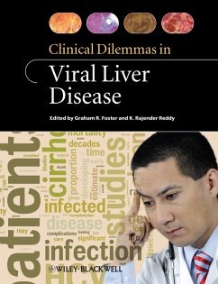 Clinical Dilemmas in Viral Liver Disease (eBook, PDF)