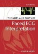 The Nuts and bolts of Paced ECG... - Bild 1