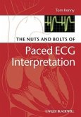 The Nuts and bolts of Paced ECG Interpretation (eBook, PDF)