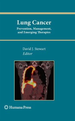 Lung Cancer: (eBook, PDF)