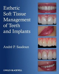 Esthetic Soft Tissue Management of Teeth and Implants (eBook, PDF) - Saadoun, Andre P.